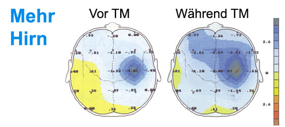 Mehr-Hirn durch TM Mehr Hirn durch TM